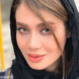 لنز چشم دهب مدل لومیر براون کد 17 رنگ عسلی روشن